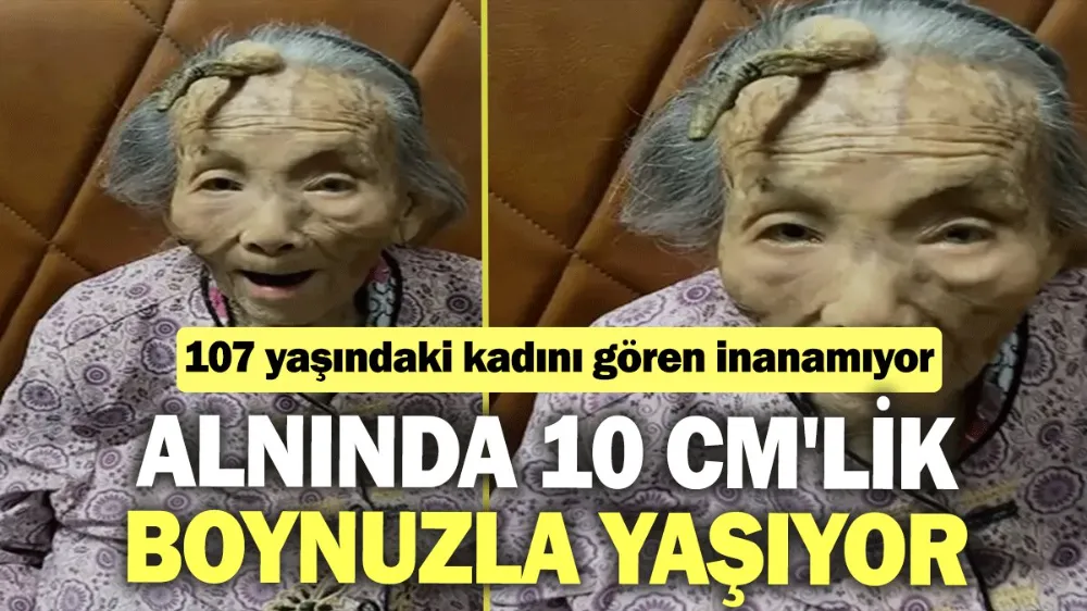 Alnında 10 cm