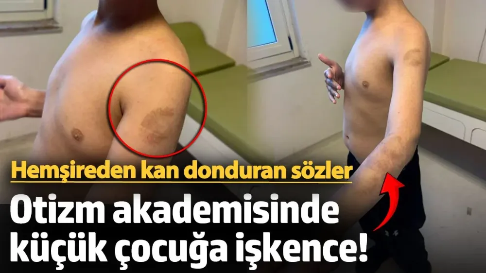 Otizm akademisinde küçük çocuğa işkence! 