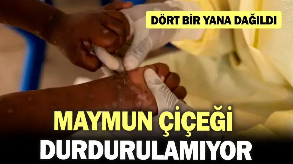 Maymun çiçeği durdurulamıyor!