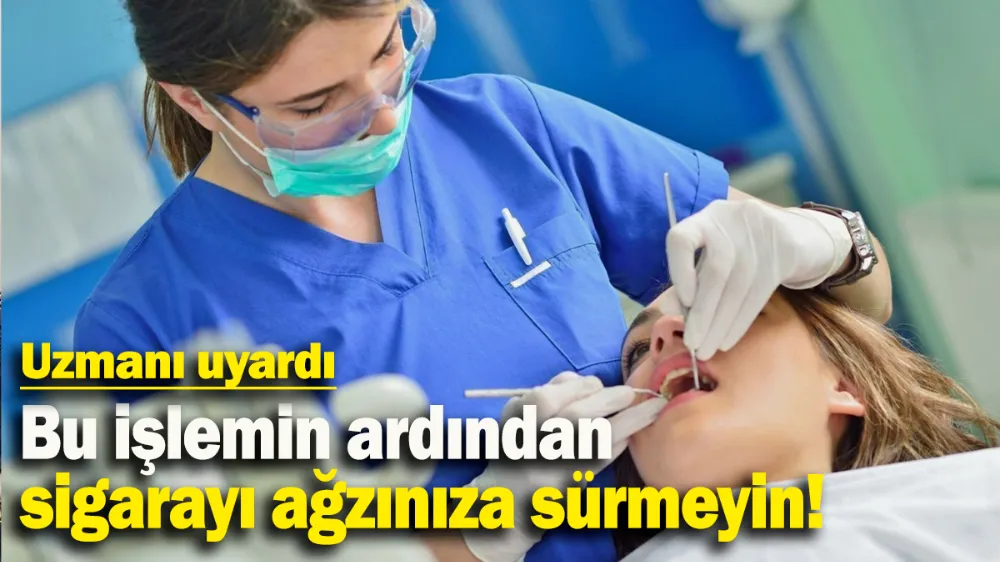 Bu işlemin ardından sigarayı ağzınıza sürmeyin