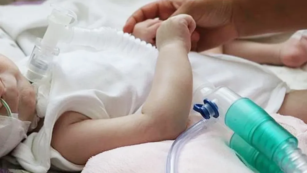 Protokol imzalandı! SMA tedavisinde kullanılan ilaç Türkiye