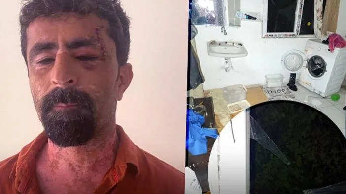 Antalya’da öfkeli damat dehşet saçtı! Kayınpederini öldüresiye dövdü