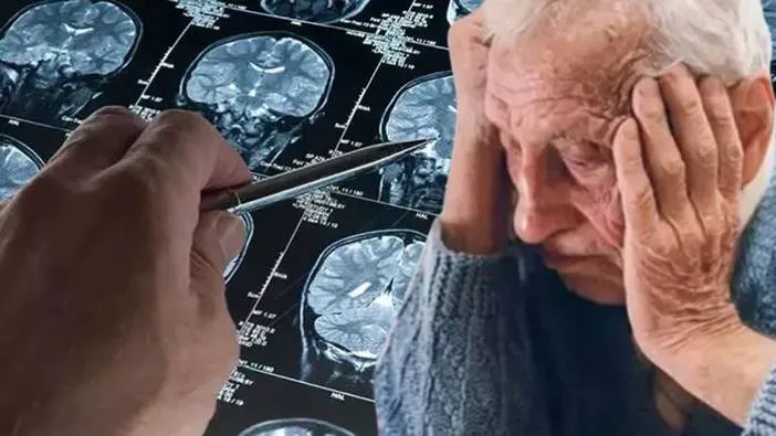 Alzheimer’ın 8 gizli tetikleyicisi ortaya çıktı! 